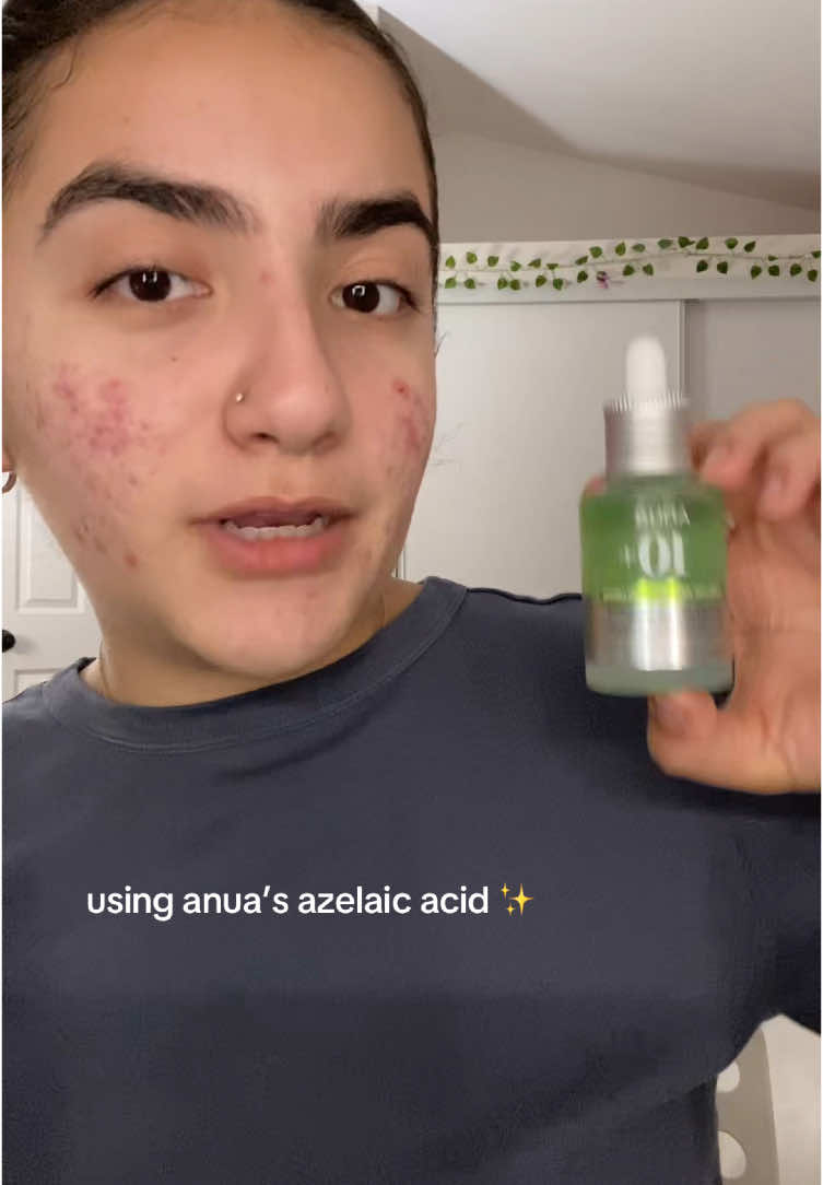 azelaic acid overall is to help any acne, hyperpigmentation, skin texture or uneven tone. 🫧🌟  i know it’s only been a week and you may not see MAJOR results but i see my scaring less inflamed. #anua #azelaicacid #acne #acneskin #anuaazelaicacidserum  #acnetreatment  #acnemarks #acnescare #ulta #sephora @anua_global 