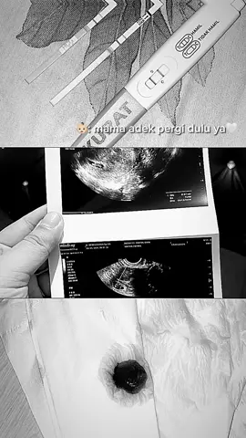 Anak surga mama papa🥹❤️#keguguran #kuretase #keguguran2bln #CapCut 