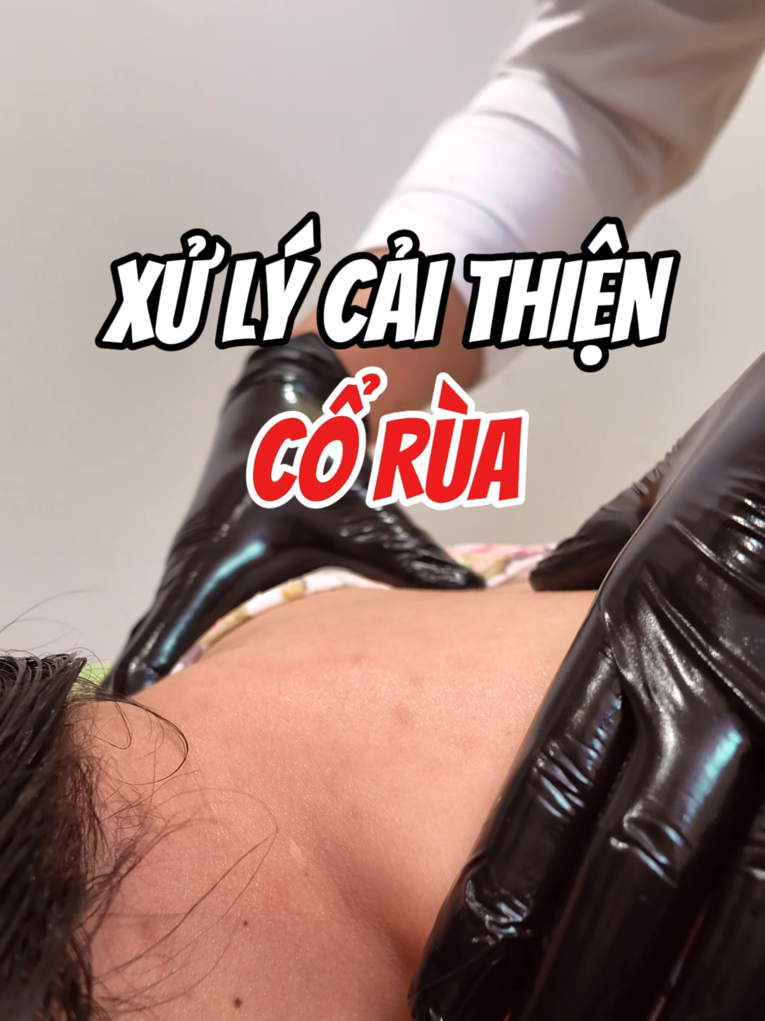 XỬ LÝ CẢI  THIỆN CỔ RÙA  #sigmaviencoxuongkhop #xuhuongtiktok #coxuongkhop #chamsocsuckhoe #xuhuong #sigmacare #viencoxuongkhopsigma #vatlytrilieu