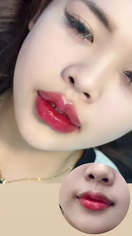 baby 2 quả ai ưng không ạ😍😍 Liên Hệ với EM Linh để được tư vấn & đặt lịch (filler botox, chỉ xịn xò ạ / bao check tan, bảo hành 30 ngày sau tim) @345.028.503 (zl, sms) for booking Vinhomes ocean park - Gia Lâm, Ha Noi • NHẬN LÀM TẠI NHÀ •  #fullface #tiemmababy #tiemgọnhàm #tiemtai #thongonbaptay #thongonbapchan #thongonbavai #tiemmong #tiemhoinach #xoanhan 