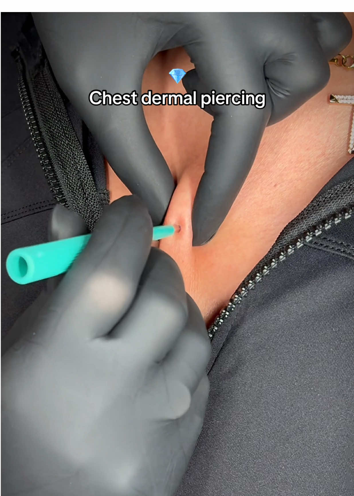 💎Chest dermal piercing done by @YoYo  Walk-ins available Underground Tattoos📍Enfield It's not a Piercing unless it's Underground! ⠀ #bodypiercings #bodypiercing #bodypiercers #dermalpiercing #microdermal #microdermalpiercing #chestpiercing #chestdermal #undergroundtattoos #enfield #fyp #viral #piercer #piercing #piercings 