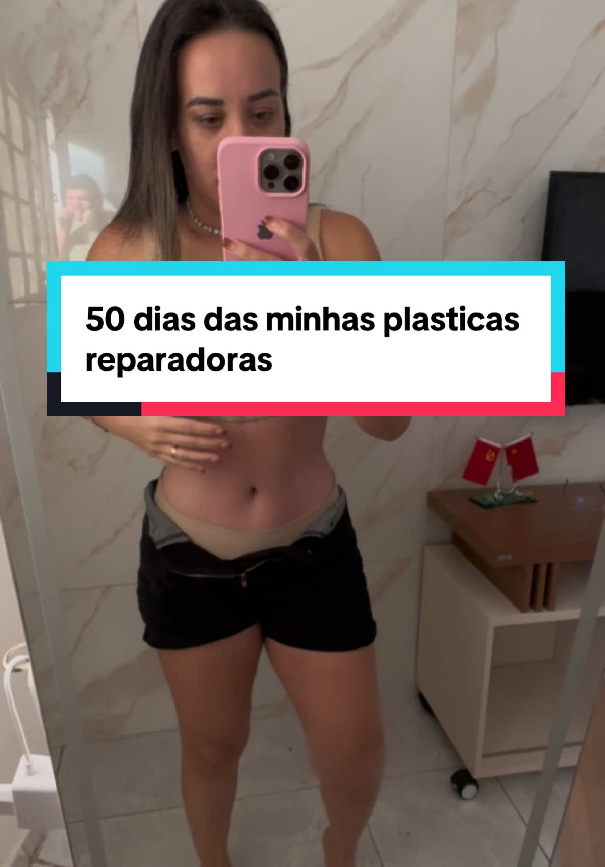 50 dias das minhas plásticas #abdominoplastia #mastopexia #bariatrica 