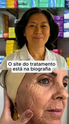 Deixei aqui no meu perfil algo para você! #pelehidratada #bigodechines #mulheres #rejuvenescimentofacial #rejuvenescer #resveratrol #transresveratrol #tratamentofacial #pelesemrugas #calcificacao #vitaminac #rejuvenescimento #skincare #pelesemmanchas #mulher #mulhertrans #pelesaudavel #acidohialuronico #pele