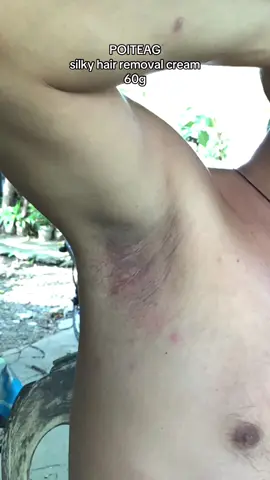 after malagyan ng cream ang part ng kilikili na may buhok mag wait lang tayo ng 10-15 minutes bago linisin.. #poiteag #hairremoval #silkyhairremoval #removalcream #fypage #affiliatemarketing #fyppppppppppppppppppppppp 
