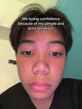 #fyp #fyppage #insecure 