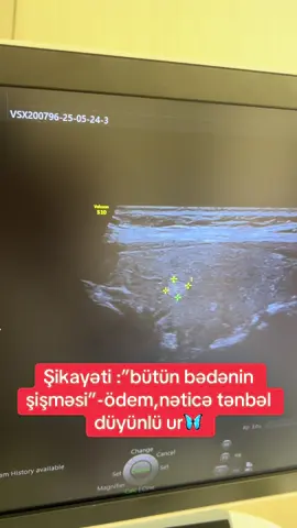 #keşfet #kesfetteyiz #diaqnoztibbmerkezi #sumqayıttibbmərkəzi #qalxanvarivez #haşimoto #tənbəlzob #düyünlüzob 