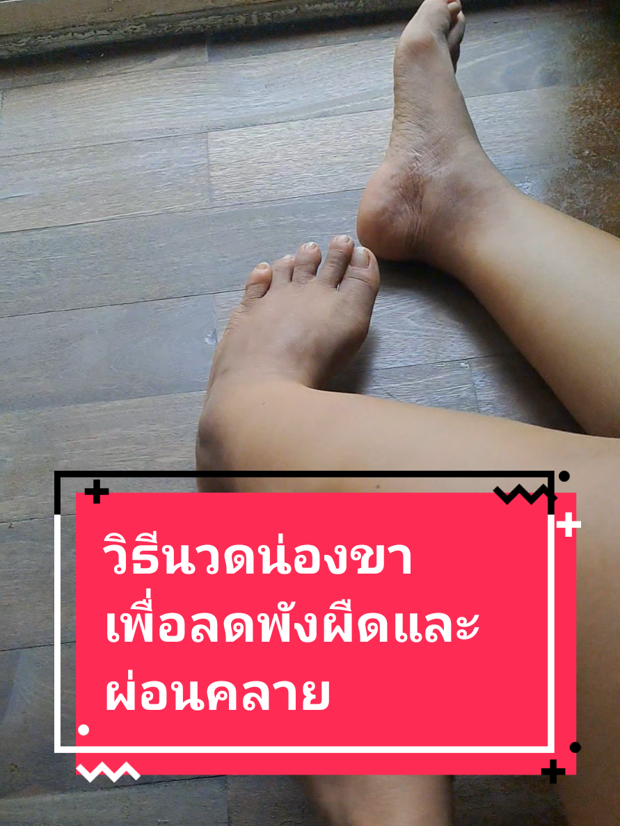 ต่อจากคลิปที่แล้วนะคะ วิธีการนวดน่องขา..ที่ต่ำกว่าหัวเข่าเพื่อลดพังผืด..ให้กล้ามเนื้อนิ่มลงลดอาการตึงรั้งและบริหารเท้าแบบง่ายๆสำหรับผู้ป่วยโรคหนังแข็ง #วิธีนวดตัวเองสำหรับผู้ป่วยโรคหนังแข็ง #วิธีดูแลตัวเองเมื่อป่วยเป็นโรคหนังแข็ง #โรคหนังแข็ง #นวดสลายพังผืด #นวดผ่อนคลายสำหรับผู้ป่วยโรคหนังแข็ง #นวดคลายกล้ามเนื้อที่ขา
