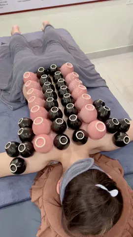 [ASRM] She feels very relaxed after cupping therapy. #massage #asmr #xuhuong #trilieuhaiphong #Giachoi #cuppingtherapy 
