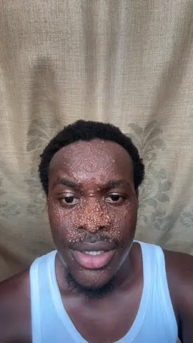I don’t know what I was doing    😭😂 facial Mask from@Vee_SkinLab🦋 