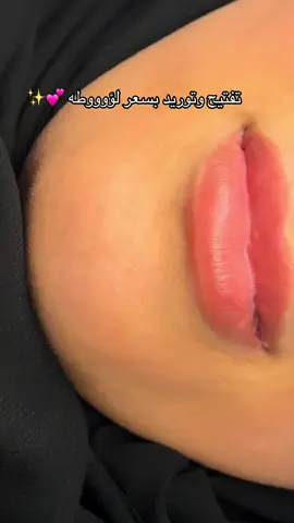 النتيجه  روووعه والاخصائية شيرين شغلها ولا غلطه بالتفتيح والتوريد وراح اوريكم التوريد اكيد 😍😍😍 #توريد_شفايف #تفتيح_شفايف #مايكرو 