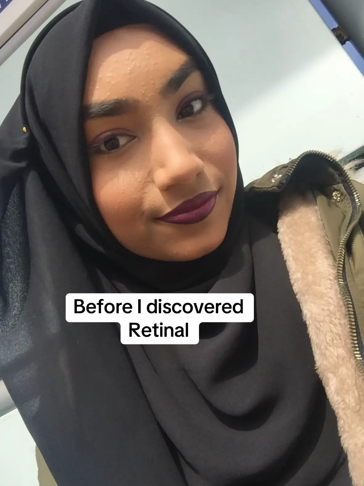 I would start at @Medik8 crystal retinal 3 and then work your way up! Iink is in my bio to shop (hyperpigmentation faves)! If you also want to learn how to add it safely then i have an advanced skincare diary you can download from my bio 🖤🫶🏽 #skincare #retinal #retinoid #medik8 #crystalretinal #retinolskincare 