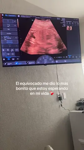 El amor de mi vida 🧸🩵