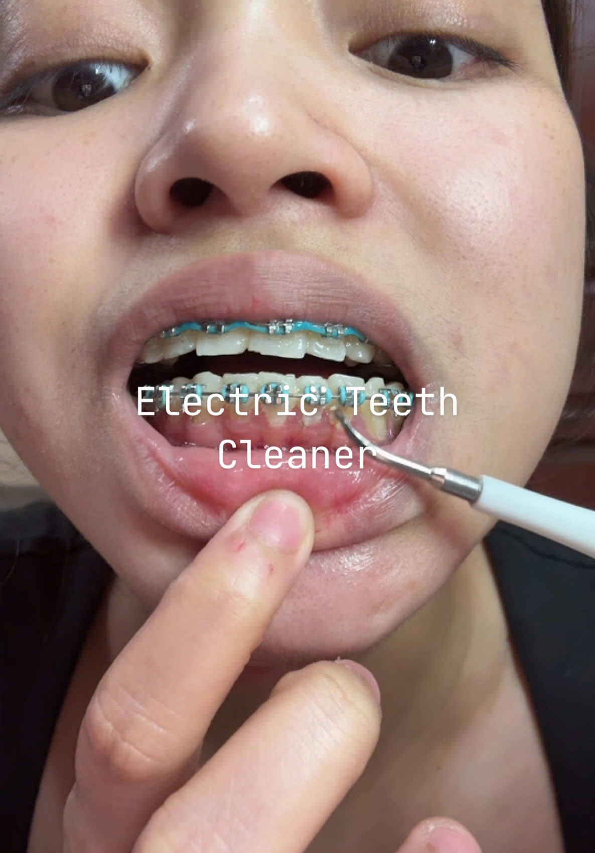 Andami grabe #electricteethcleaner #teethcare 