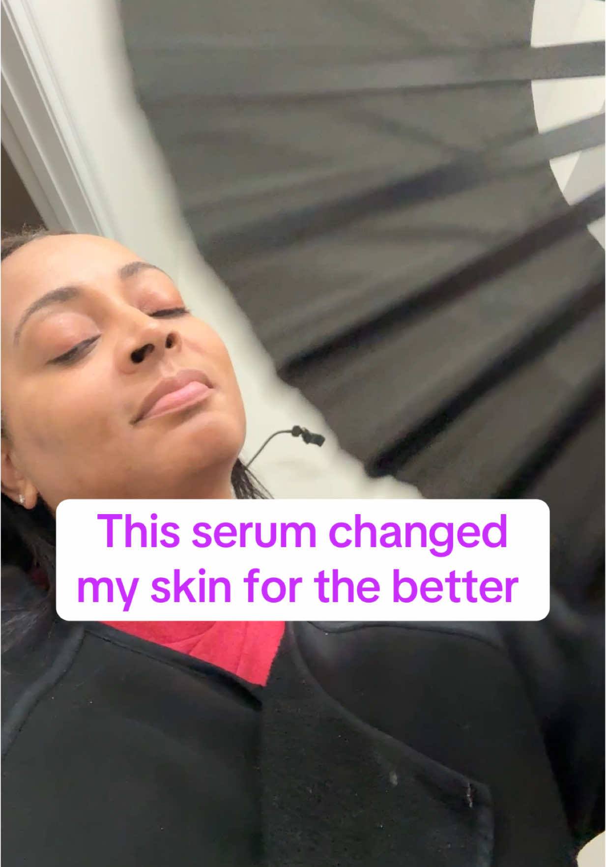 #vitaminC #skincareover40 #serum #vitamincserum #sunscreen #truskin 
