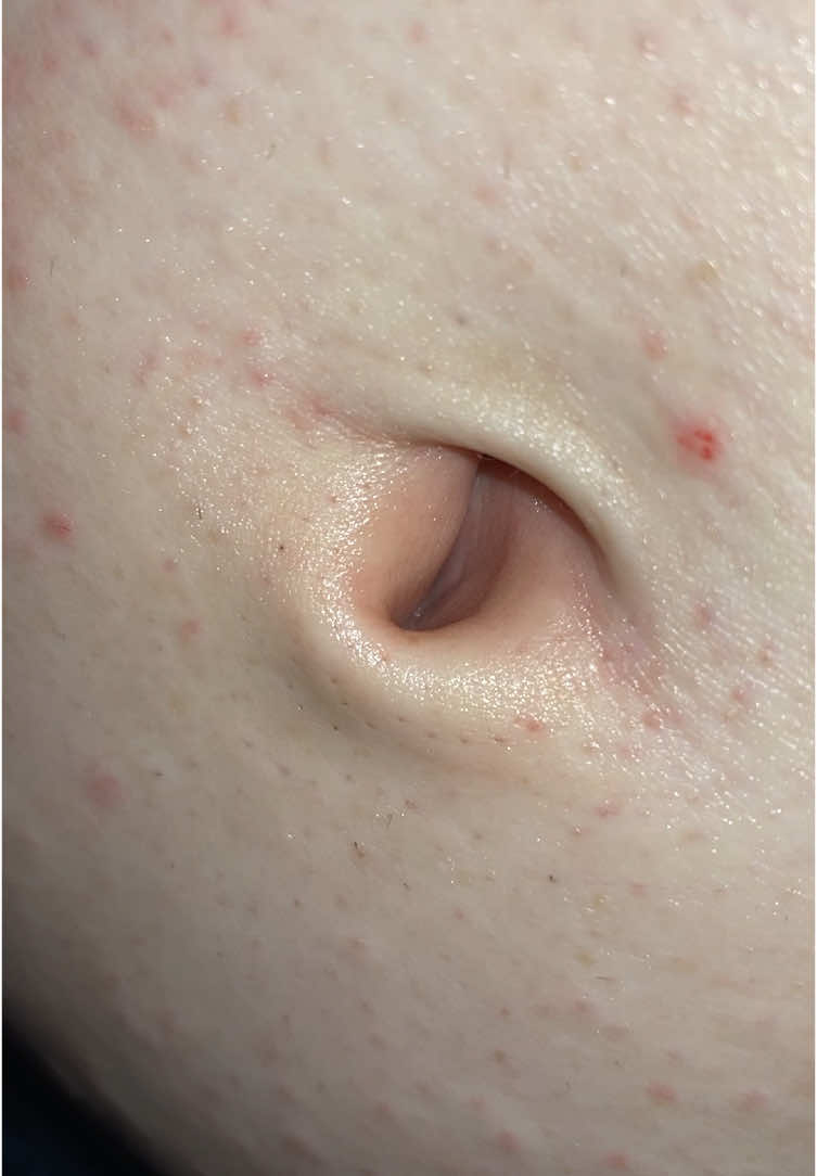 Does anyone else’s belly button open up sometimes? #fyp #fypシ #fypシ゚viral #belly #bellybutton #innie #outie #navel #omblingo #fy #fpryoupage #exam #closeup #detail 