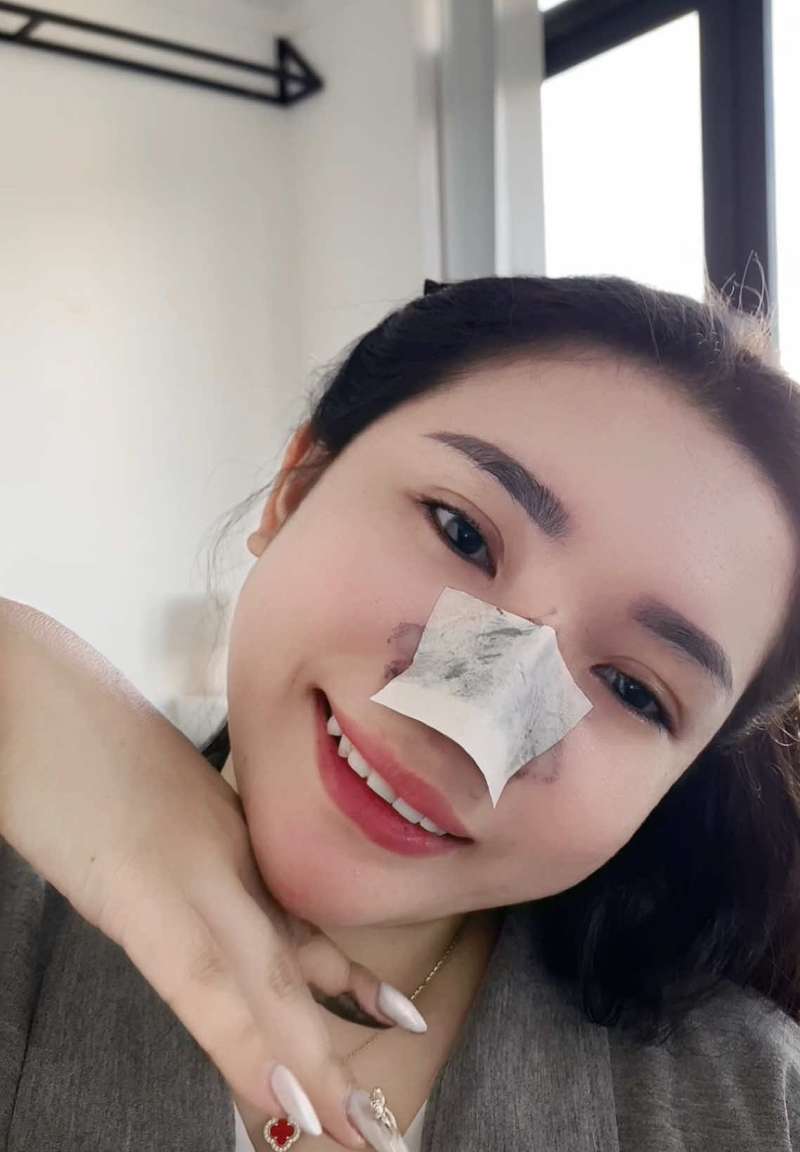 Từ ngày có ẻm tui đã không còn lo những em mụn đầu đen trên mũi nữa #ACNE22 #gellotmun #mundauden #skincare #elemformulas