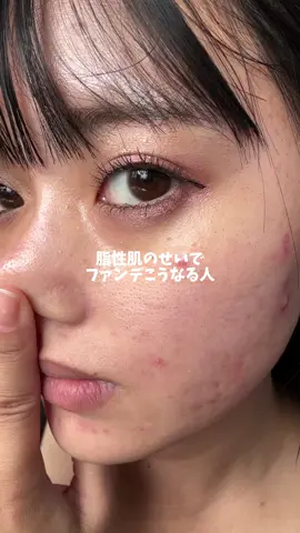 脂性肌どうにかしたい子は絶対これだよ🥺💓 #PR #フリアージュ #Frieage #美容 #垢抜け #可愛くなりたい #スキンケア #美容液