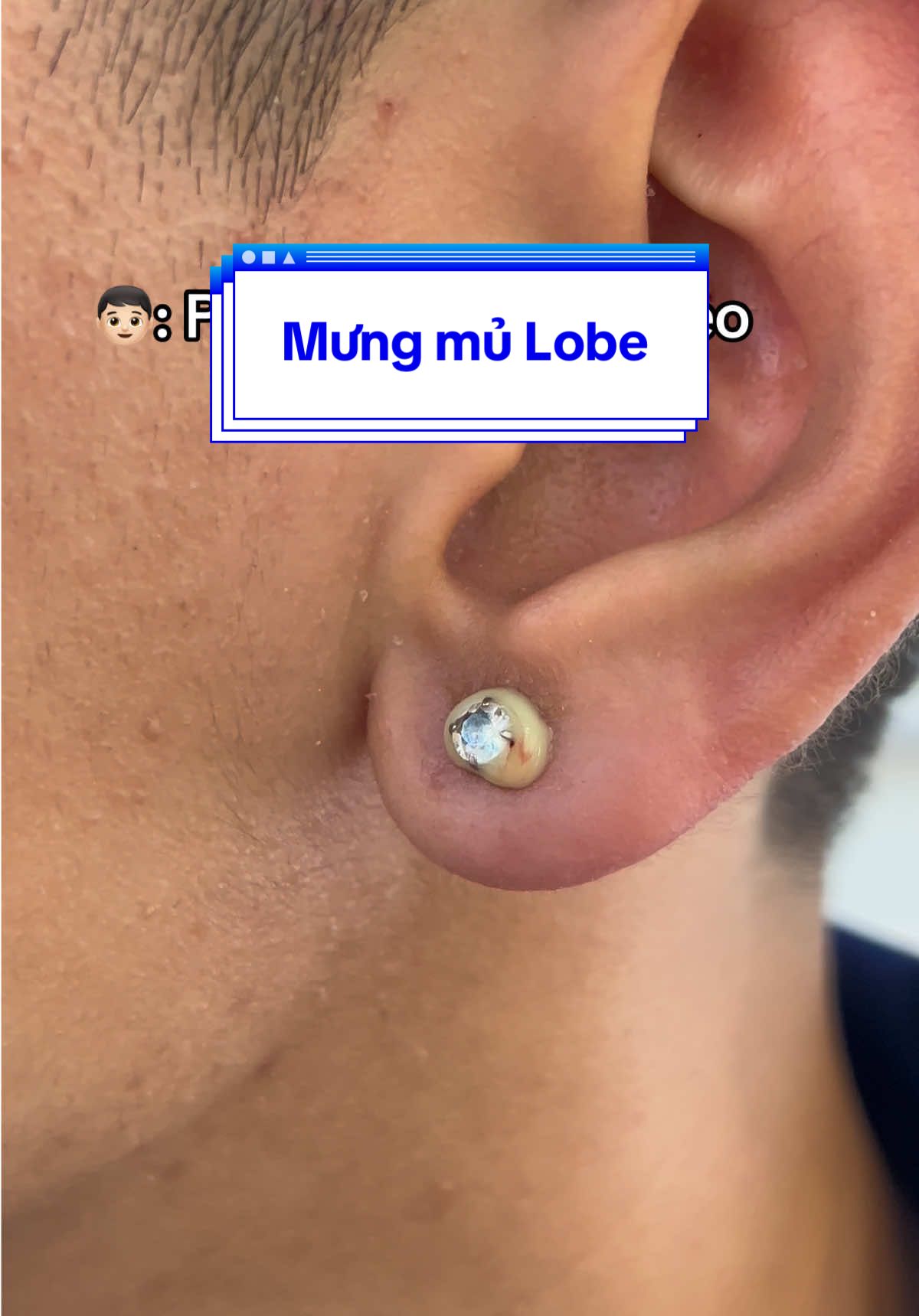 Topping đi kèm với xỏ khuyên 🤦🏻‍♀️ #xuhuong #xokhuyenbacninh #abcxyz #f #piercing 