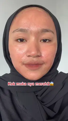 mukanya merah kenapa tu😱 ternyata pake peeling solution😍#brighty #brightyindonesia #mencerahkankulit 