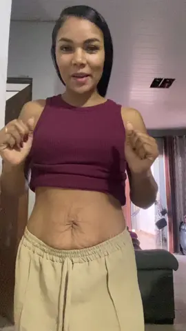 Estrias pós gestação barriga com flacidez  #fyyyyyyyyyyyyyyyy #adeusestrias #estrias #estriasbarriga #barrigaflacida #estriasnuncamais #flacidezabdominal #flacidezpostparto 