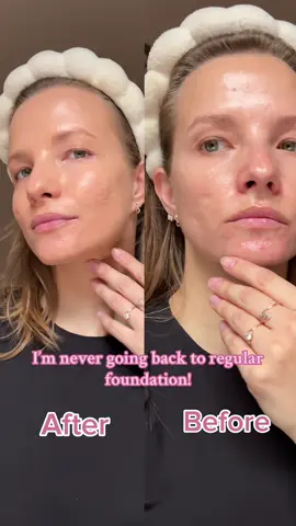 This one’s a keeper! Never going back to regular foundation💗 #ugccreator #contentcreator #ugcexample #beforeandafter #neutrogena #neutrogenafoundation #acneproneskinmakeup #acnepronefoundation #CapCut  @Neutrogena 
