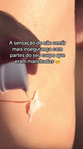 A vida começa a ter esse som ❤️ #clareadordemanchas #manchas #autocuidado 