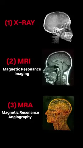 #x-ray#MRI#MRA