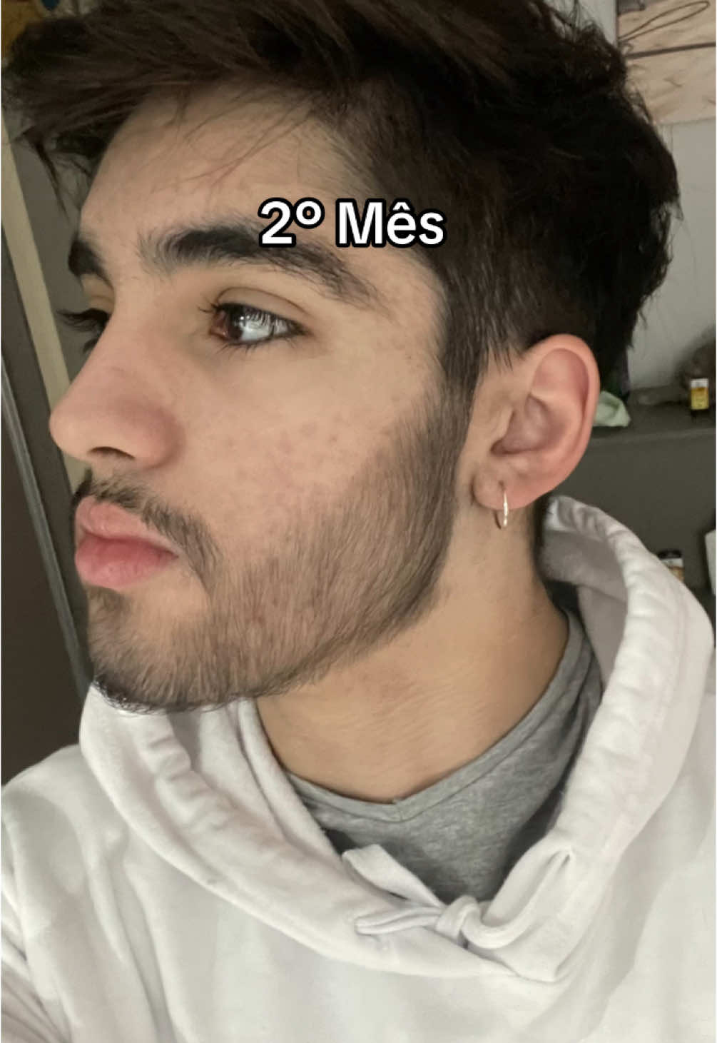 Pede que mando aonde comprava o minoxidil kirkland original, tem muita falsificação por aí  #barba #minoxidil #foryoupage 