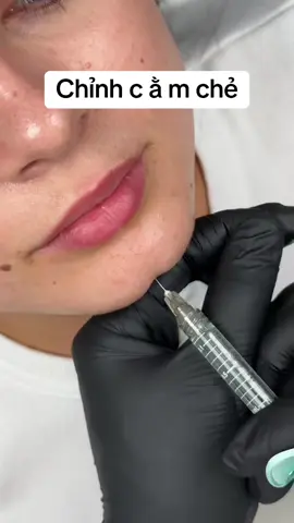 #camtailoc #fullface #moibaby #thaiduong #mahop #mababy #botox #filler #xh #xhtiktok #tiemmoi #tiemcam #fyp #longan #binhchanh #kimnganbeauty