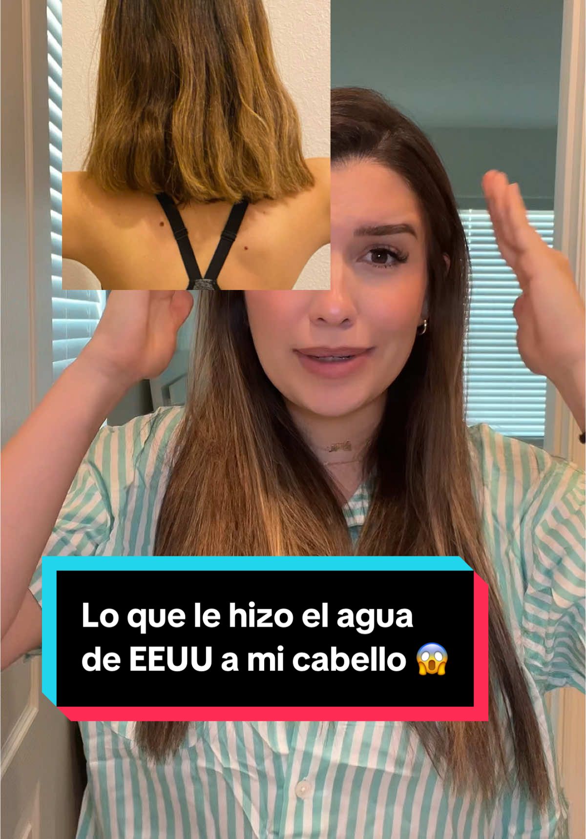Menos mal conseguí este producto y ya no soy pelo en pausa 🤣😅 #onionvital #naturalsant #romero #biotin #naturalsantusa #serum #hairtok #fyp #recomendation #benefits 