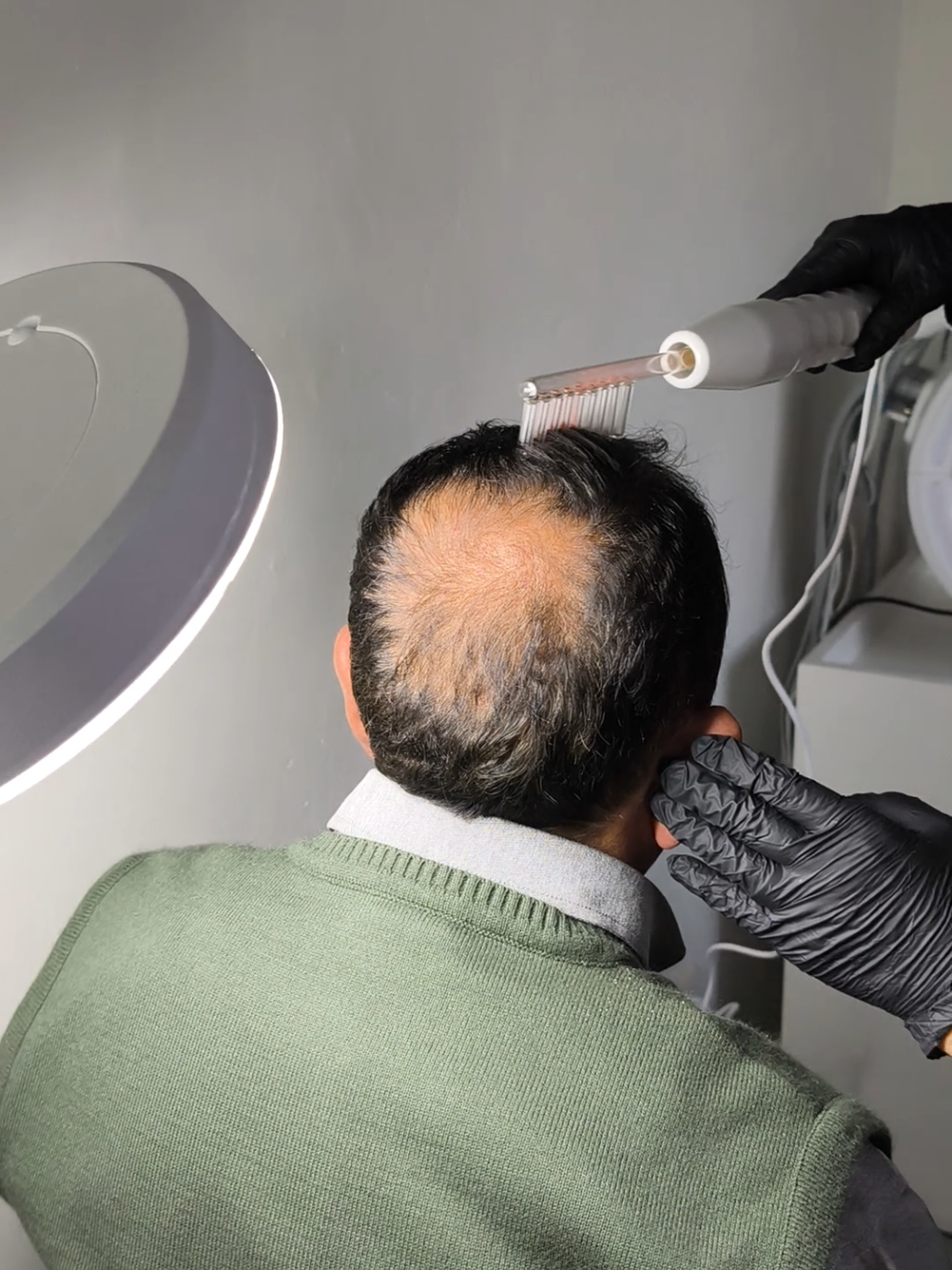 Ellos también se cuidan la piel y se vienen súper promos por el día del padre!!! #botox #plasma #capilar #tratamientosparaelcabello #arequipa #fyp 