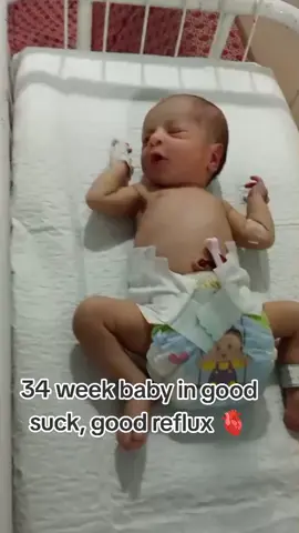 We take children to the N.I.C.U. (Neonatal Intensive Care Unit) when they are newborns who need special medical care. This can happen for several reasons: Premature birth – if the baby is born before 37 weeks of pregnancy. Low birth weight – if the baby weighs less than 2.5 kg at birth. Breathing problems – some newborns have trouble breathing and need support. Infections – if the baby has or is at risk of infection. Jaundice or other medical issues – requiring monitoring or treatment.#newborn  #nicu  #babylove  #preemie  #babycare  #momlife  #parenting  #foryou  #foryoupage  #fyp  #viral  #trending  #tiktoktrend  #explorepage 