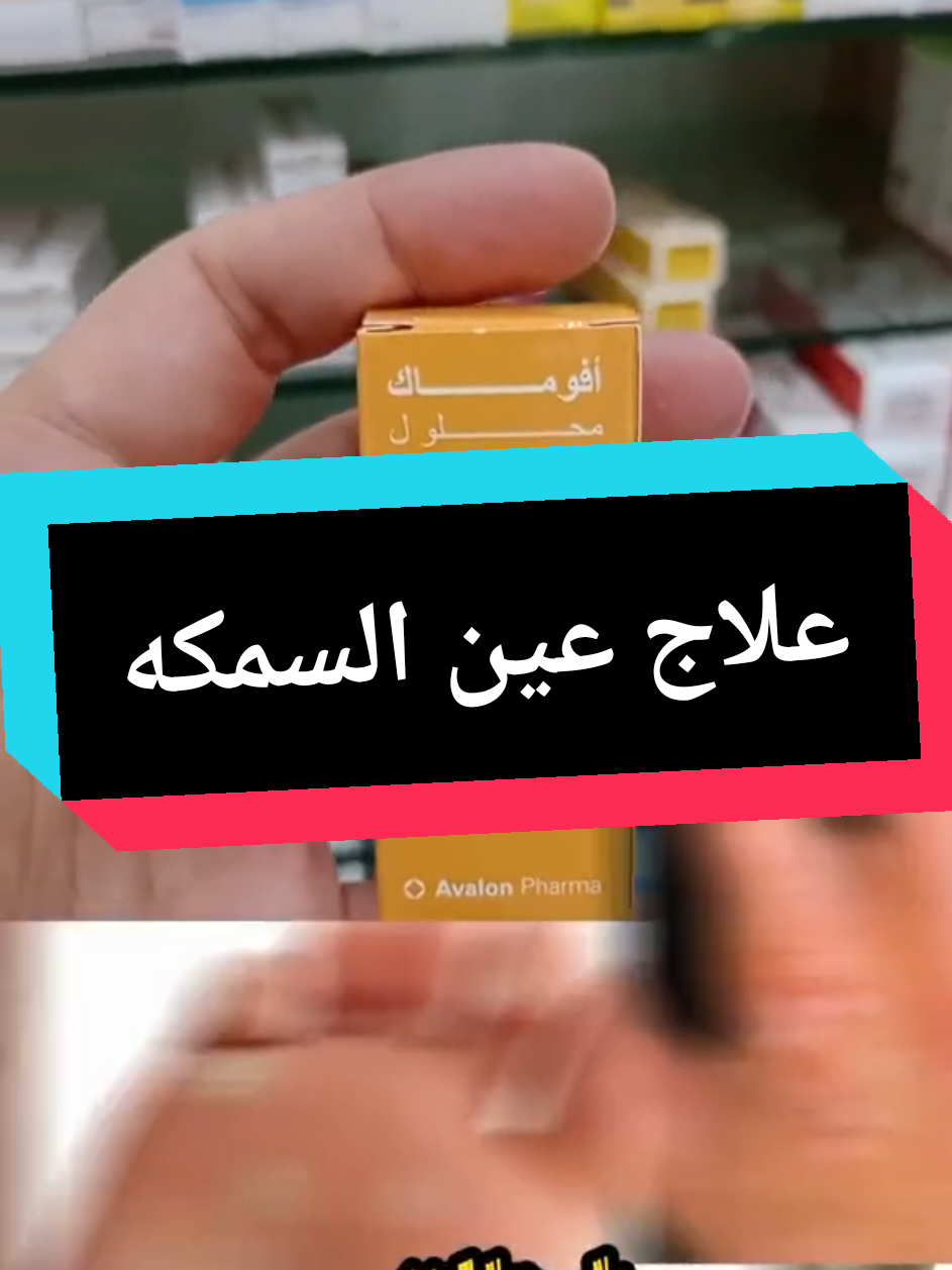 كيفية علاج عين السمكه  #creatorsearchinsights  #سمكه #fyp #دسعيدالتهامي 