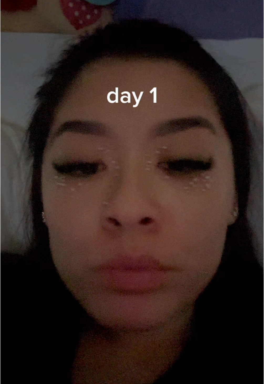 the results yall been waiting for....day 1 lowk ate #miliatreatment #cryotherapy 