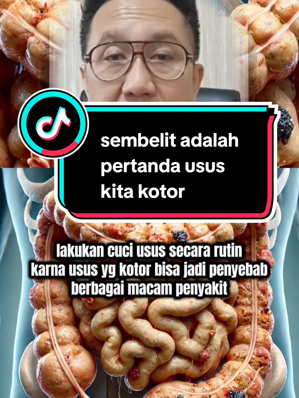Membalas @indah.u..a lakukan cuci usus secara rutin, supaya kotoran didalam usus bisa dikeluarkan dengan baik lewat bab, supaya bab nya lancar, karna sembelit itu menumpuknya kotoran didalam usus, dan itu bisa menyebabkan berbagai macam penyakit #cuciusus  #detoksifikasi  #detoxususkotor  #tehdetoxazbo 