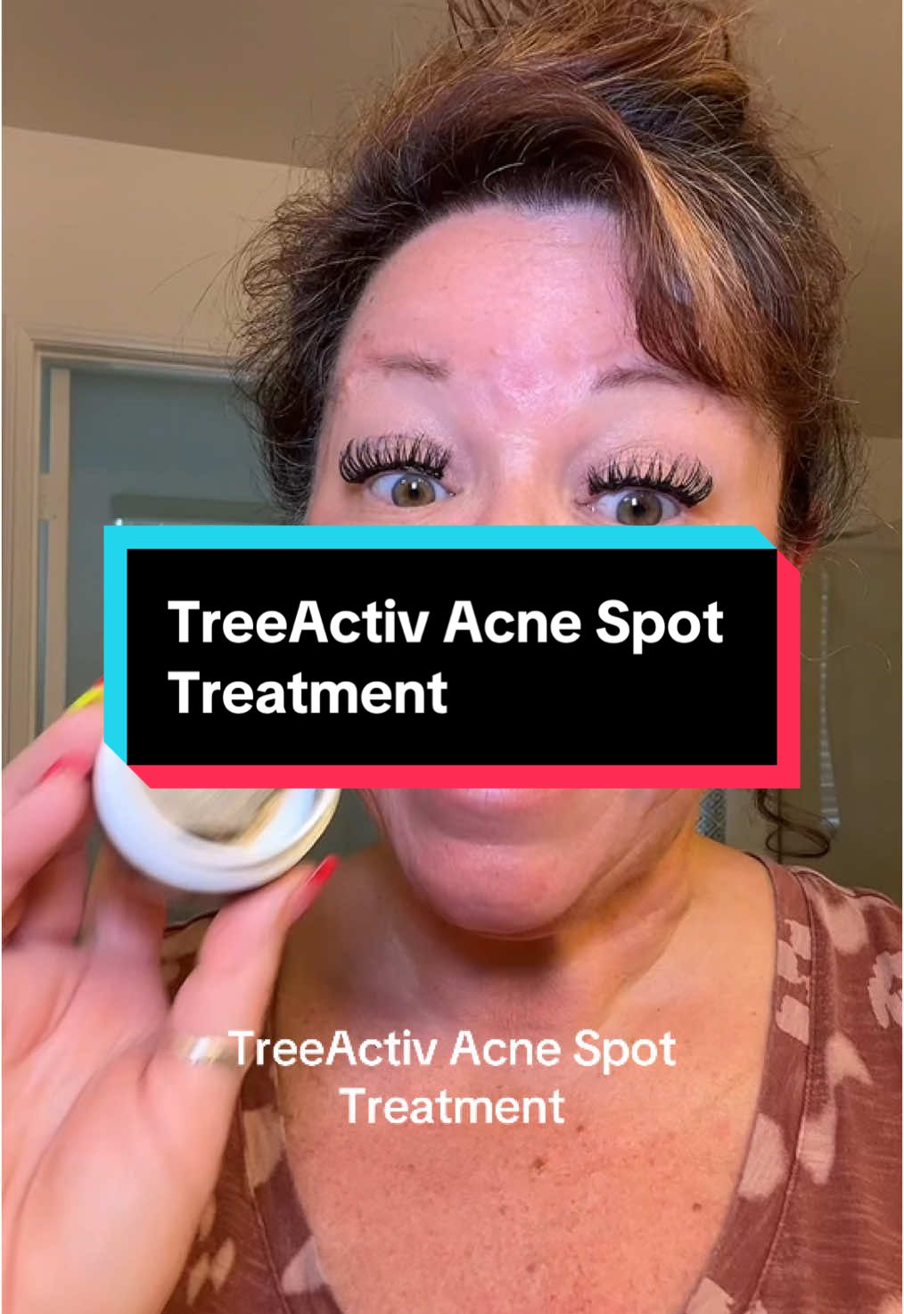 TreeActiv Acne Spot Treatment #acne #acnetips #treeactiveskincare #treeactiv #skincare #pimples #tiktokshopfinds #tiktokshopcreatorpicks #tiktokshopsummersale #tiktokshopsummerturnup #dealsforyoudays #resultsmayvary 