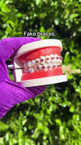 Fake clip-on braces link in bio💙