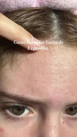 Retinal>cualquier producto #skincare #skincarecoreano #seoul1988 #retinal #lineasdeexpresion #arrugas #arrugasfaciales #retinalserum #retinolskincare #retinolserum #coreanskincare #skincaretips #skincarecoreana #kbeauty #pielsinarrugas #imperfecciones #coreanitos @@KSECRET GLOBAL #7days 