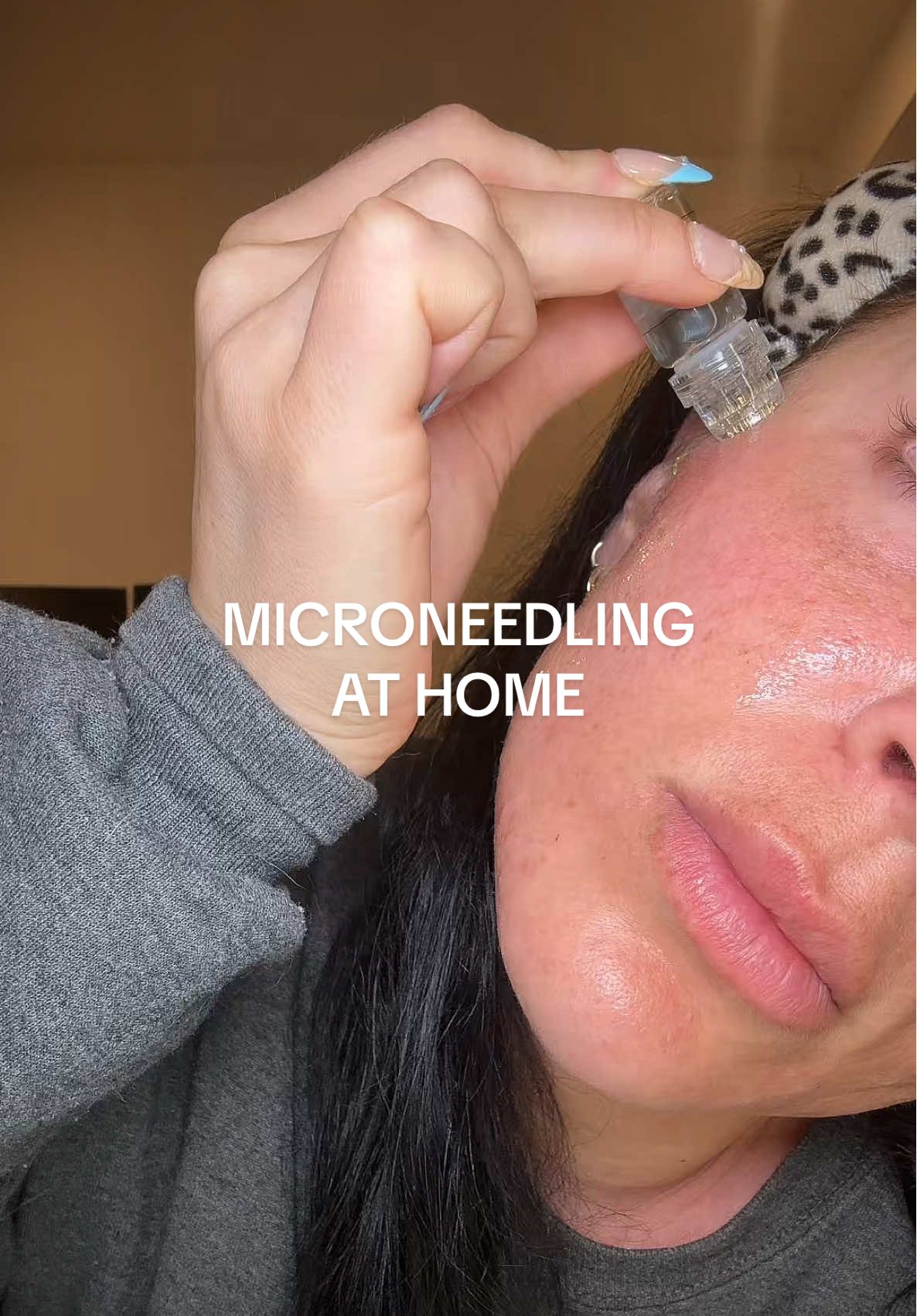 Microneedling at home with this Microinfusion kit 🙀 #diybeauty #microneedlingface #microneedlingathomesafely #skincare 