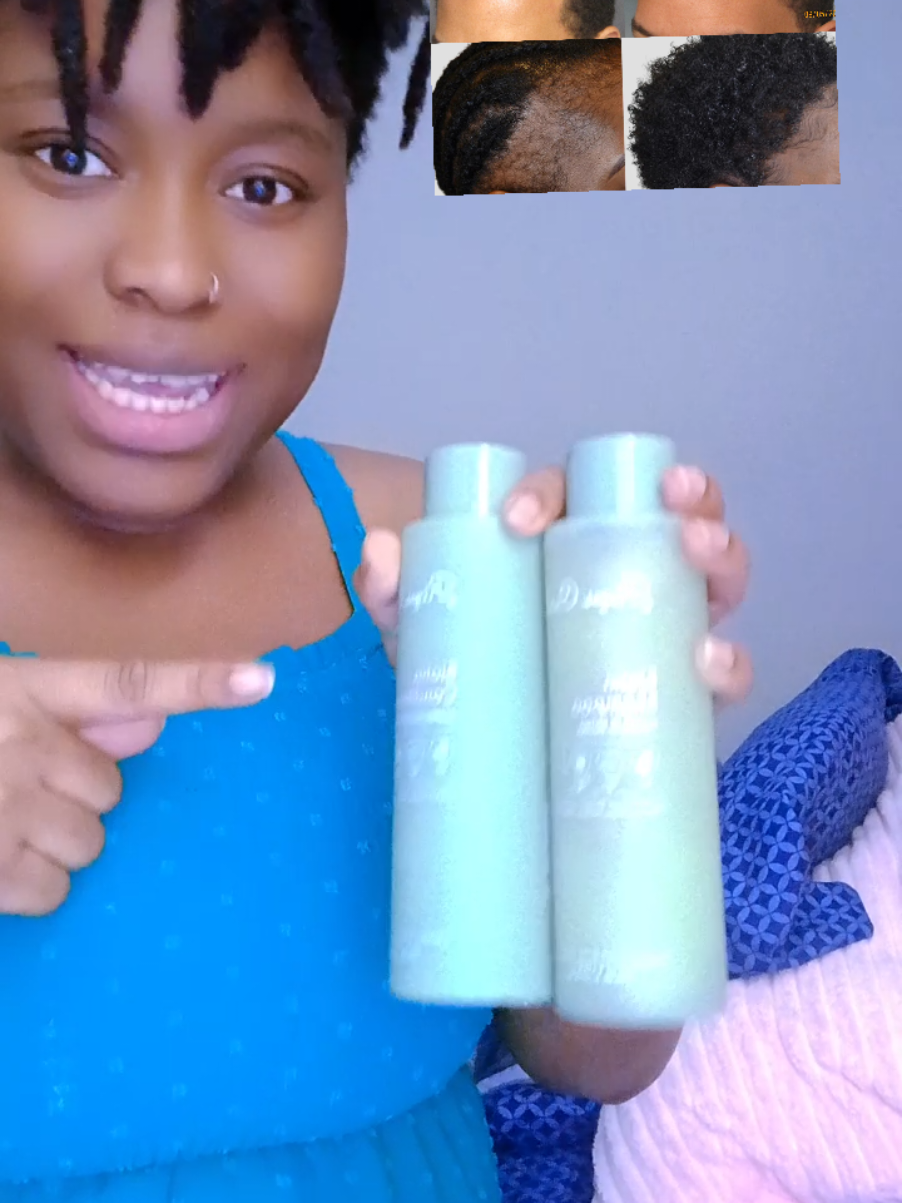 #viral #fyp #skincare #abbiyahben #Abbiyahbackup #naturalproduct 