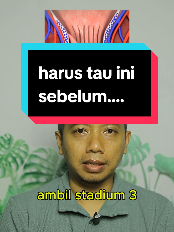 Ada 4 stadium pada ambeien atau wasir #wasir #ambeien #hemoroid #sakitsaatdusuk