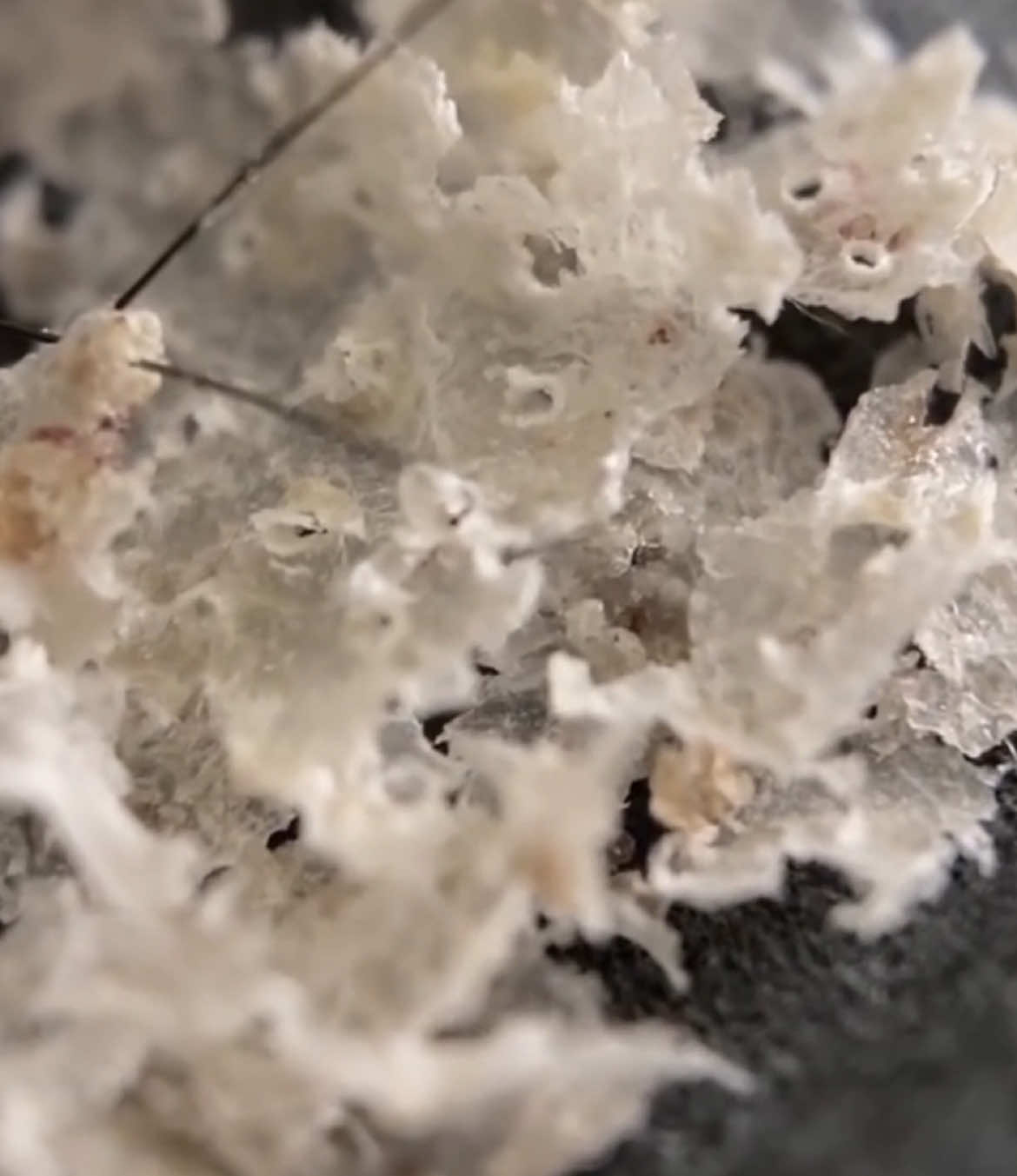 Close-up view of dandruff removal #scalpcare #scalpclean#itchyhead  #haircare #scalp #Itchyrelief #scalpcare #scalppsoriasis  #scalptreatment