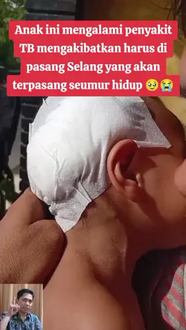 Kenapa harus pakai selang seperti itu? Pada kasus Meningitis TB, infeksi bisa menyebabkan penumpukan cairan di otak yang disebut hidrosefalus. Cairan ini disebut CSF (Cerebrospinal Fluid). Normalnya, cairan ini diproduksi dan diserap secara seimbang, tapi jika ada gangguan seperti: Saluran penyerapannya tersumbat karena infeksi. Produksi cairan lebih banyak dari yang bisa diserap maka cairan akan menumpuk dan menekan otak. Jika tidak ditangani, bisa menyebabkan: Sakit kepala hebat. Kejang-kejang. Gangguan penglihatan. Gangguan pertumbuhan dan perkembangan. Kerusakan otak permanen atau bahkan kematian. Fungsi VP Shunt: Selang (shunt) ini mengalirkan cairan berlebih dari otak ke perut, agar tidak menekan otak. Karena sistem otak tidak bisa pulih normal, shunt harus dipasang seumur hidup, tapi biasanya perlu diganti setiap beberapa tahun sesuai pertumbuhan anak. #fyp #viral #trending #info #TB 