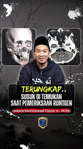 Susuk...