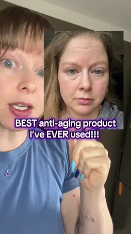 I am BLOWN AWAY!!! #womenshealth #womenover40 #collagen #wrinkles #antiaging #skincare #beautyhacks #beautytips 