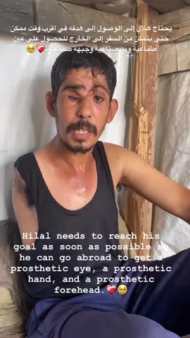 Since I'm still in unbearable pain, it's impossible for any human being to endure pain, if you can't help us, your prayers are enough. بما أنني لا أزال في ألم لا يُحتمل، فمن المستحيل على أي إنسان أن يتحمل الألم، إذا لم تستطع مساعدتنا، فإن صلواتك تكفي. #followers #fuy