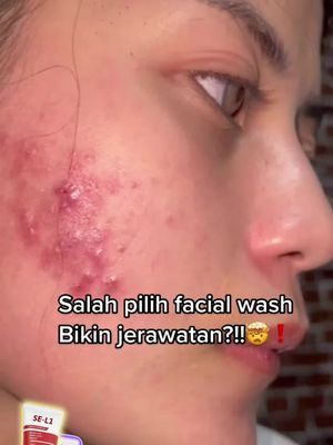 Kulit Halus dan Cerah,Skin&Cleaning Pembersih Wajah NiacinamidePemutih