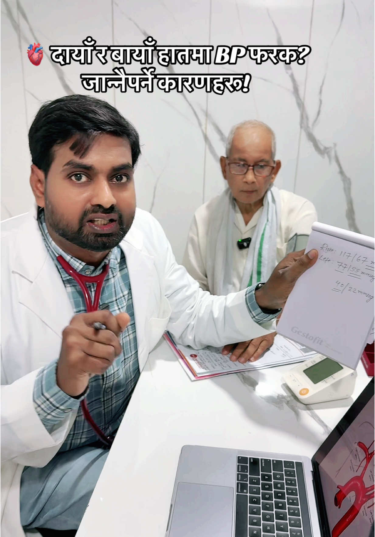 #creatorsearchinsights 🩺 दुवै हातको रक्तचापमा ४०–५० mmHg को फरक – के यो गम्भीर संकेत हो? यस जानकारीमूलक भिडियोमा, हामीले एक ६८ वर्षका वृद्ध व्यक्तिमा देखिएको दाहिने र बायाँ हातको रक्तचापमा ४०–५० mmHg को असामान्य अन्तरलाई ध्यानपूर्वक विश्लेषण गरेका छौं। 🔍 भिडियोमा समेटिएको छ: 	•	यस्तो रक्तचाप अन्तर किन हुन्छ? 	•	के-कस्ता रोग अवस्थाहरू यस्तो फरकको कारण हुन सक्छन्? 	•	Clinical significance र चिकित्सकहरूले यसलाई कसरी मूल्याङ्कन गर्छन्? 🩺 सम्भावित कारणहरूमा: 	•	Subclavian artery stenosis 	•	Aortic dissection 	•	Peripheral artery disease (PAD) 	•	Takayasu arteritis 	•	र अन्य महत्त्वपूर्ण संवहनी रोगहरू यो भिडियो मेडिकल पेशाकर्मी, विद्यार्थी, र स्वास्थ्यप्रति चासो राख्ने सबैका लागि अत्यन्त उपयोगी छ। 📽️ हेर्नुहोस्, सिक्नुहोस् र शेयर गर्न नभुल्नुहोस्। 🔔 थप यस्ता स्वास्थ्यसम्बन्धी भिडियोहरूका लागि Subscribe गर्नुस्। #BloodPressure #InterArmDifference #NepaliMedicalVideo #Hypertension #VascularDiseases #HeartHealth #fyp #fashion #nepalitiktok #tiktoknepal #travel #viral #viraltiktok #trending #foryoupage 