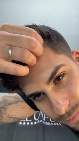 Tenho a prótese capilar que vai te deixar ainda mais bonito e com uma aparência mais jovem ! Clique no link da bio e faça sua avaliação gratuita #hairsystem #protesecapilar 