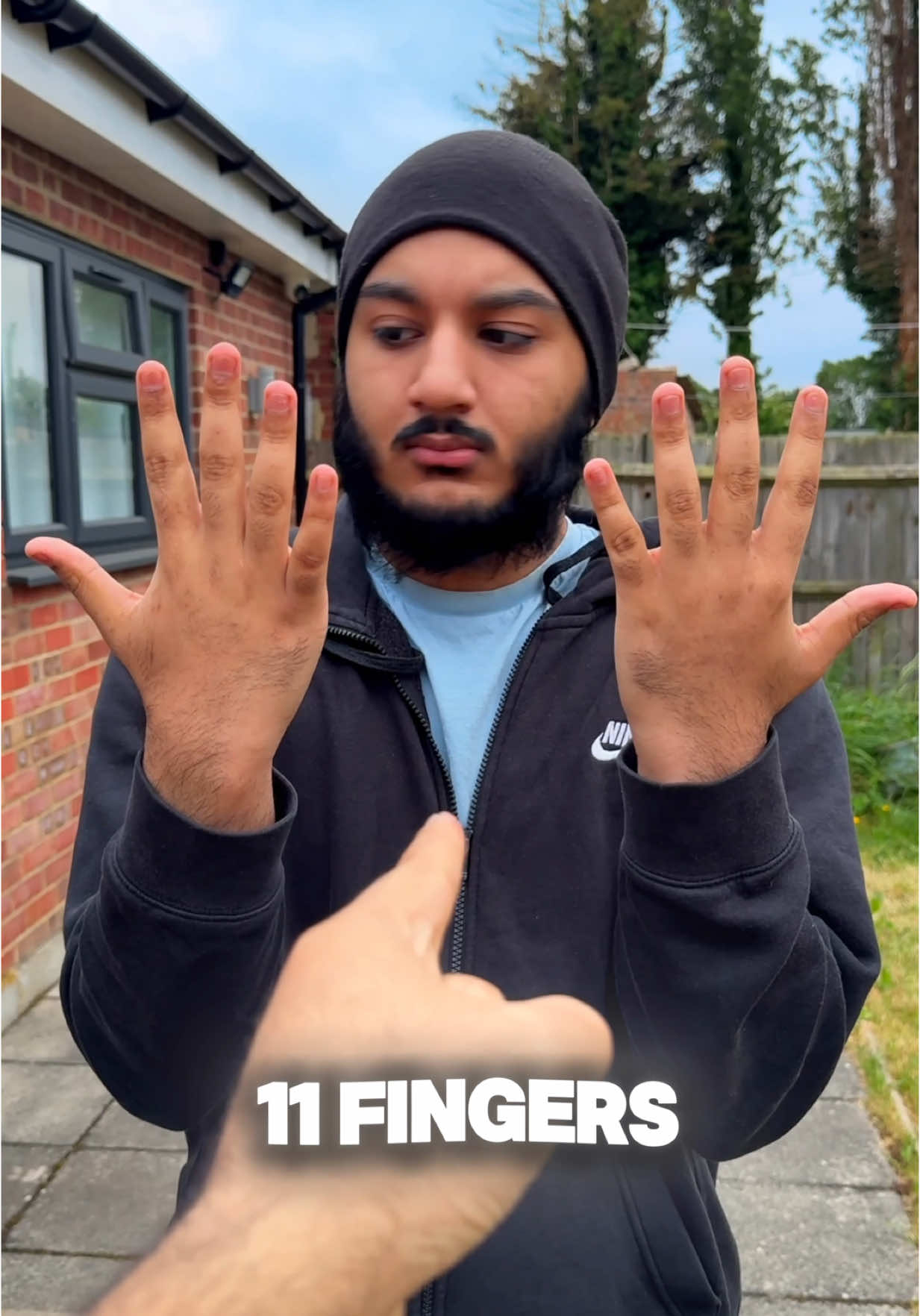 You have 11 FINGERS! 😱🤣 (How) Follow for more! ✨ #magic #trick #wow #how #illusion #confusing #math #arshsoni 